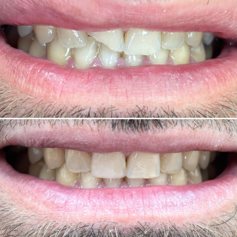 dental 246903b7 gthumb gpdatamedium2